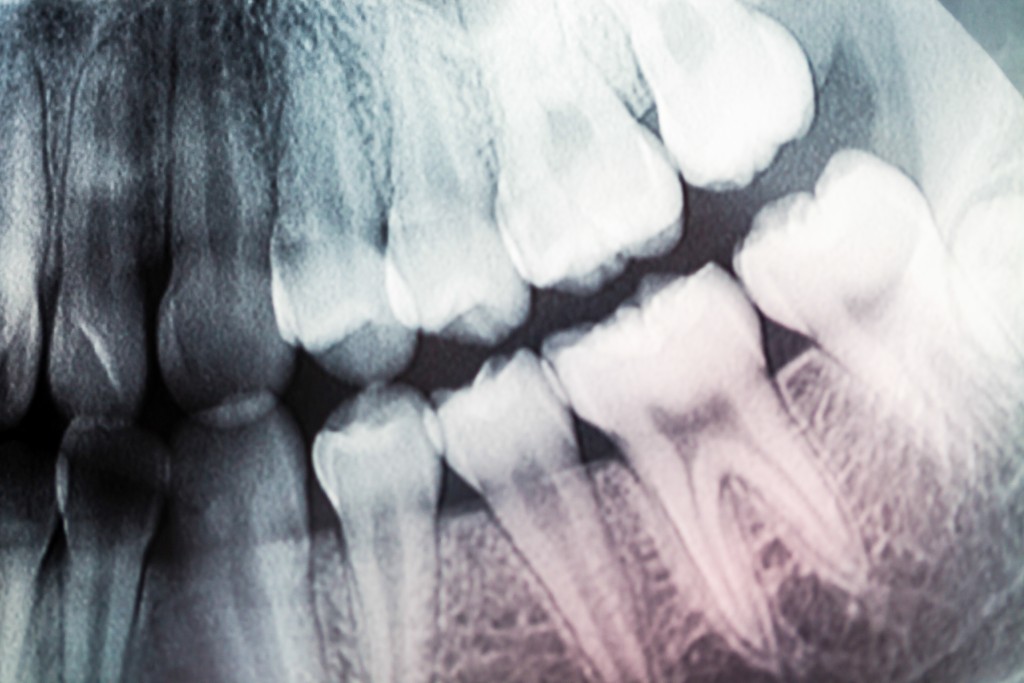 The proper disposal of dental and medical Xray film Pease Curren